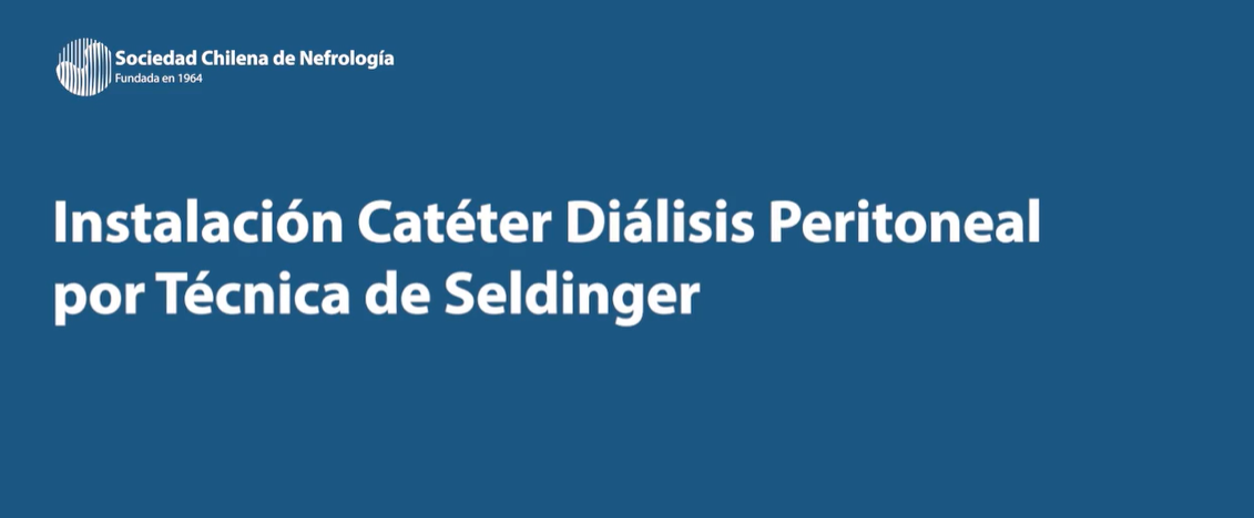 instalacion de caterer